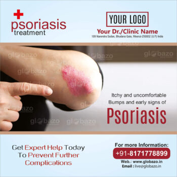 Psoriasis Treatment-ps-02