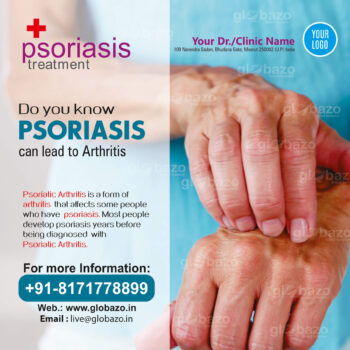 Psoriasis Treatment-ps-04