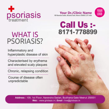 Psoriasis Treatment-ps-03
