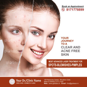 Clear & Acne Free Skin-Health-102