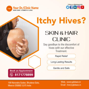 Itchy Hives? Skin & Hair Clinic-Health-76