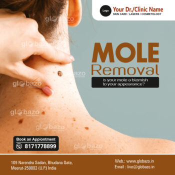 Mole Removal-Health-81
