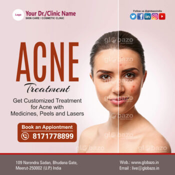 Acne Treatment-Health-88