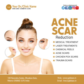 Acne Scar-Health-91