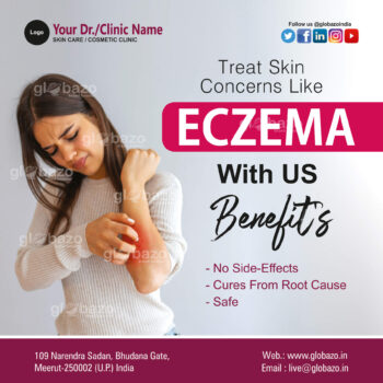 Eczema-Health-95