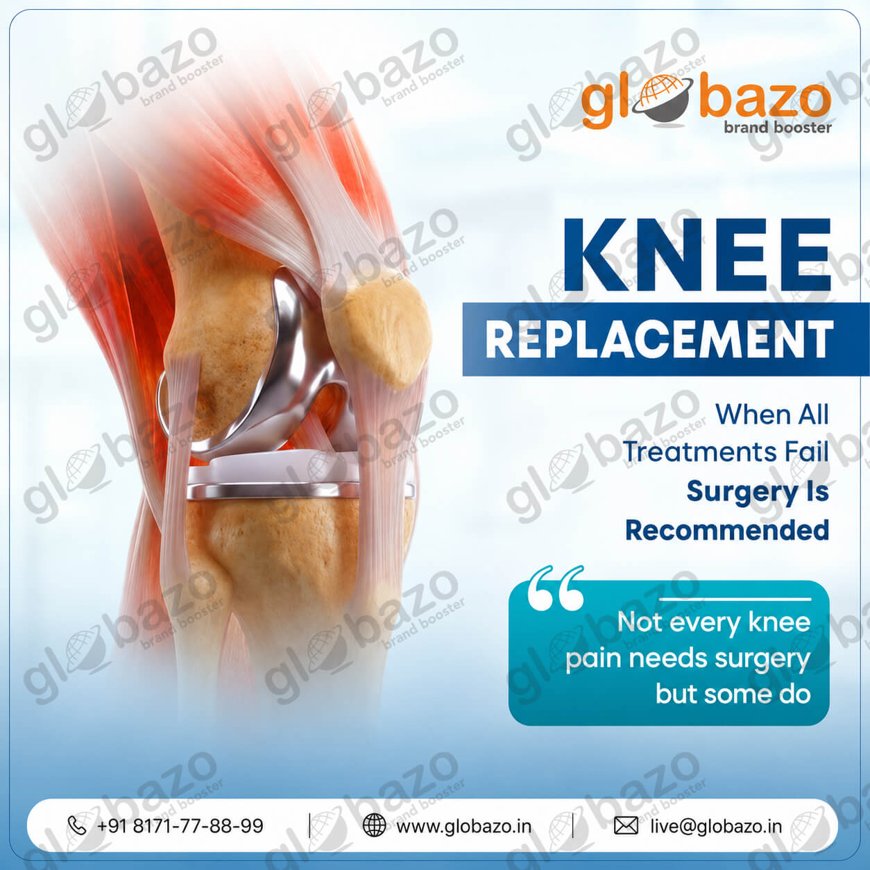 Knee Replacement (Health-238)