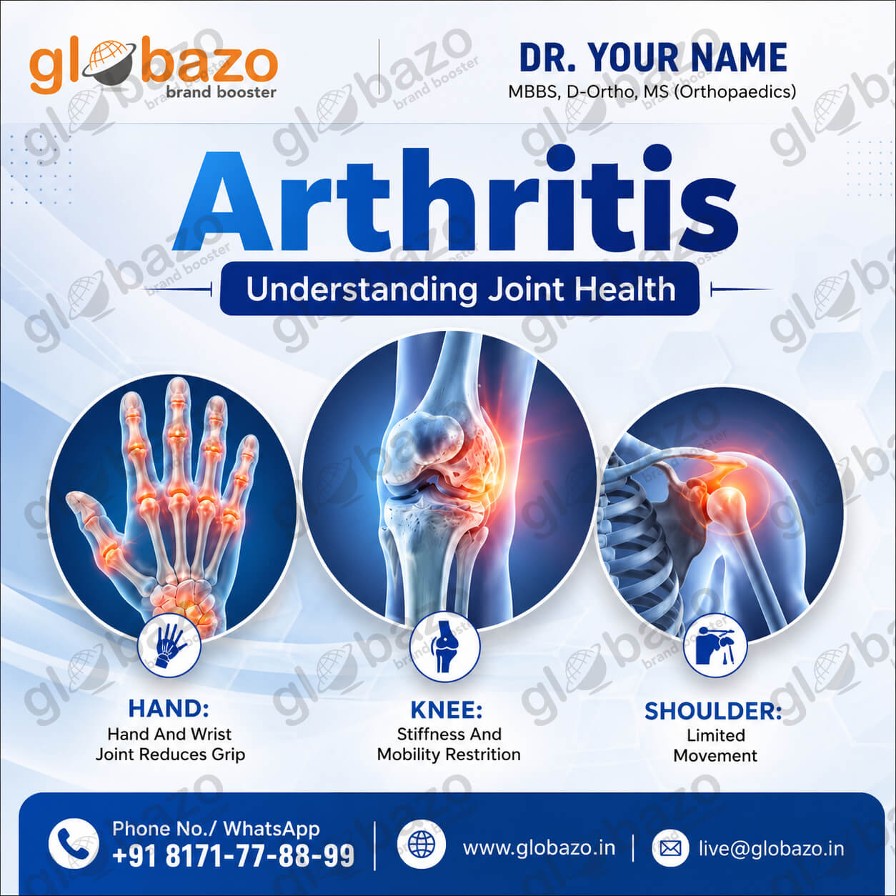 Arthritis (Health-239)