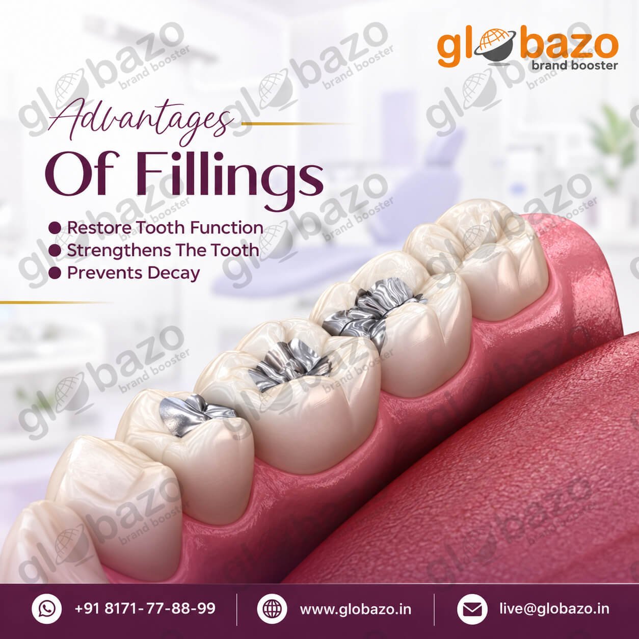 Tooth Fillings (health-297)