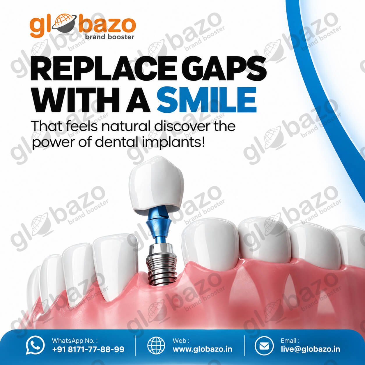Dental Implants (health-326)