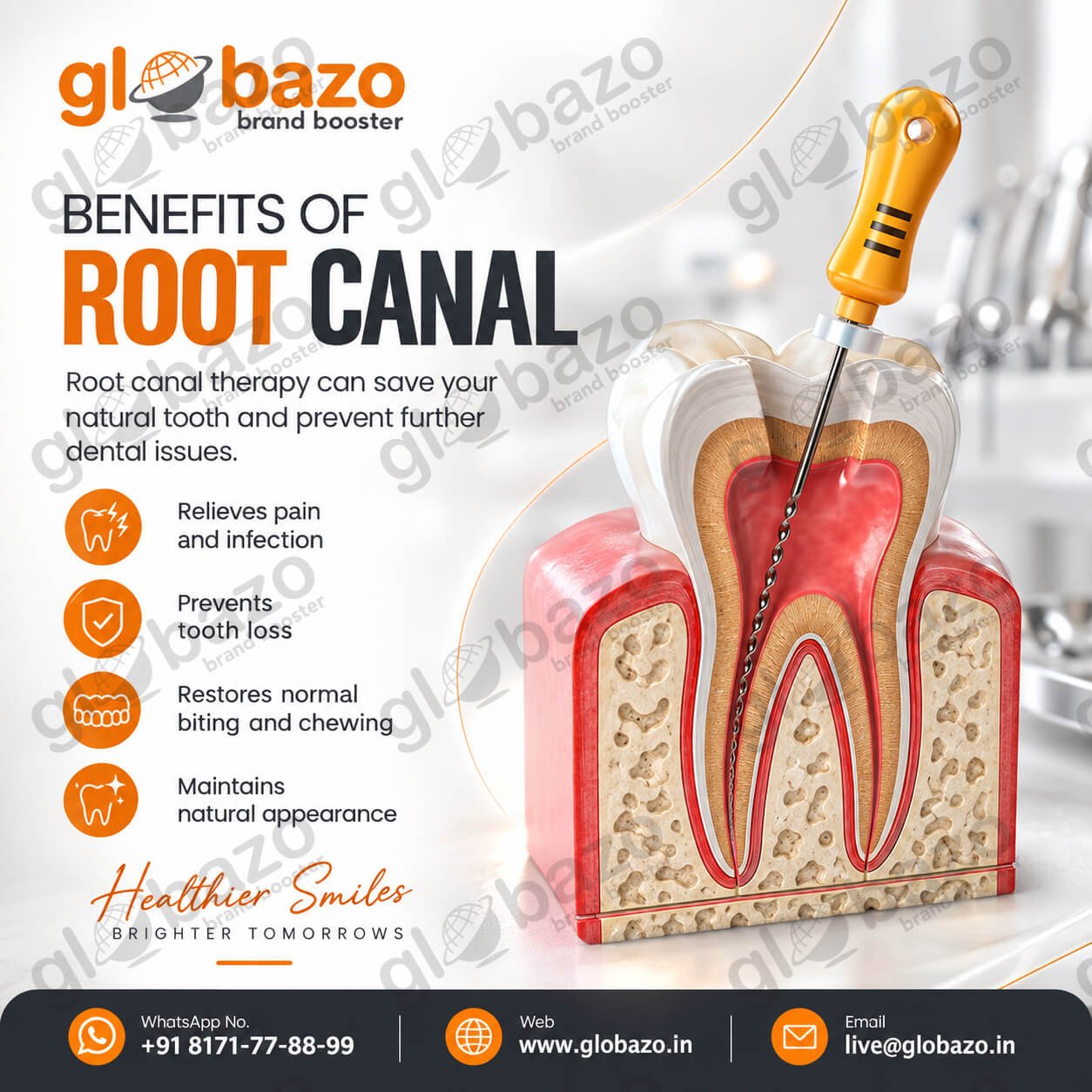 Root Canal Benefits (health-332)