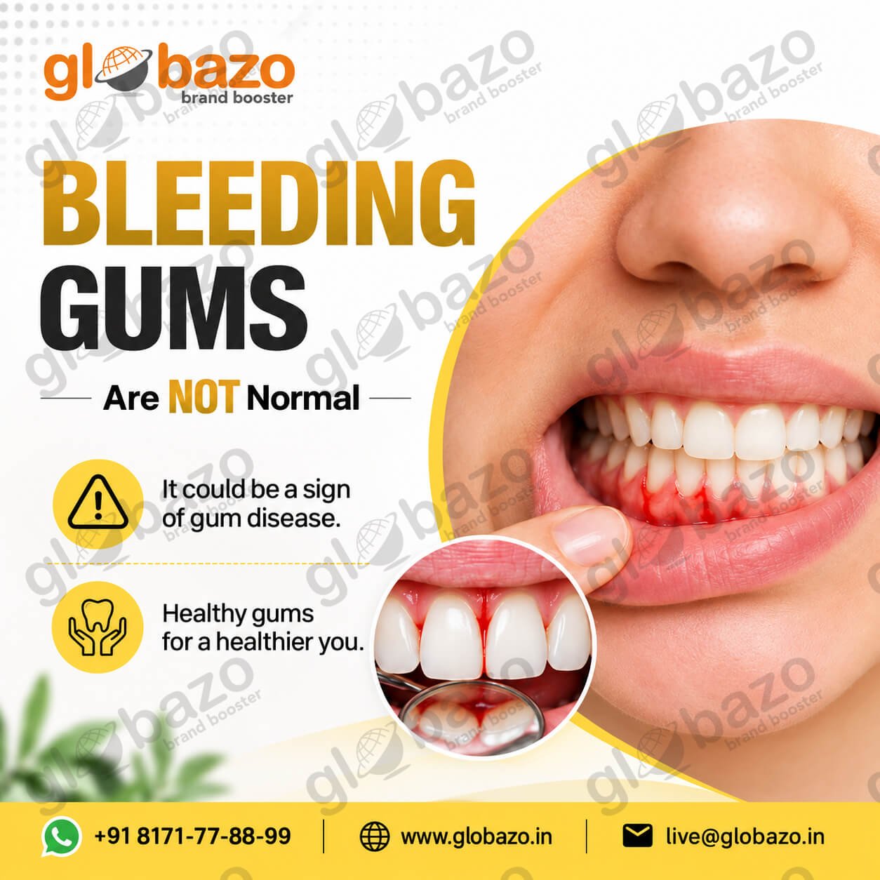 Bleeding Gums (health-342)