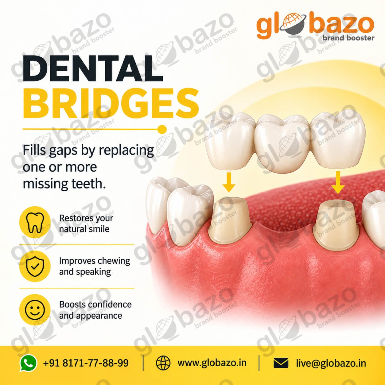 Dental Bridges (health-351)