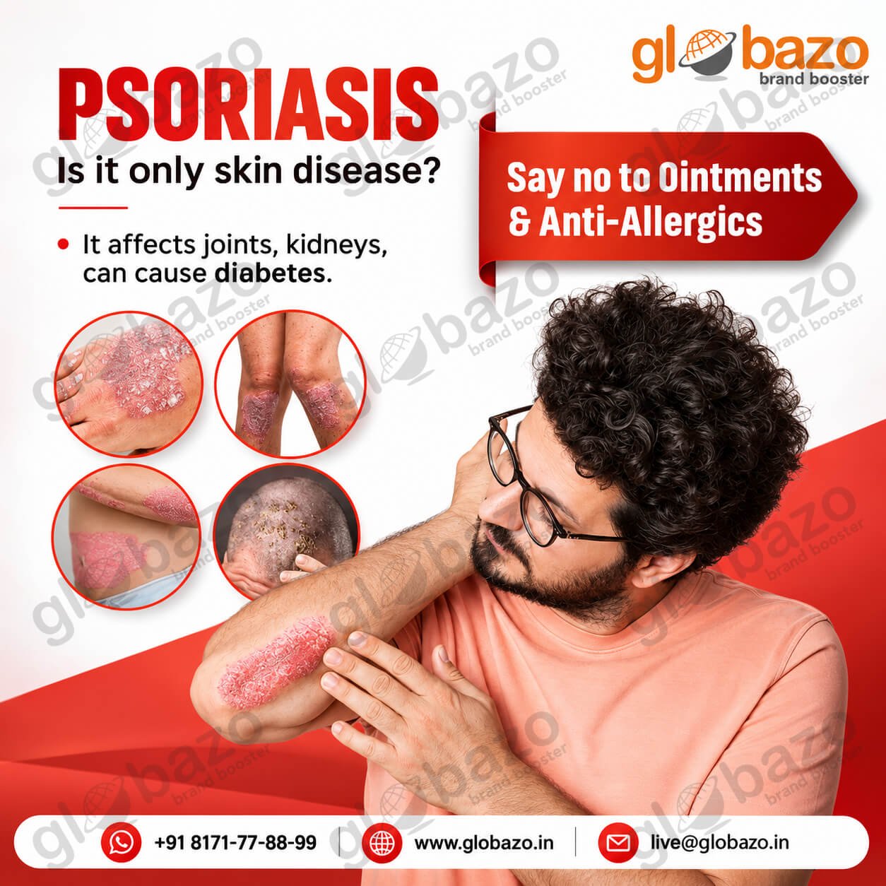 Psoriasis (Health-391)