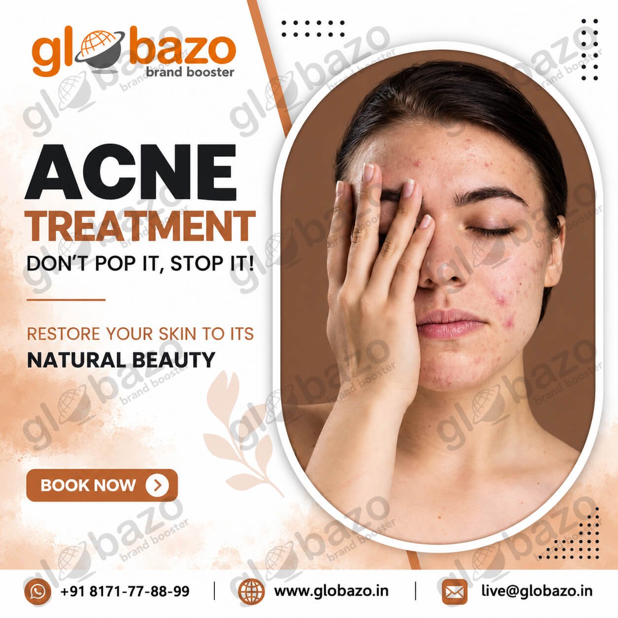 Acne Treatment (Health-393)