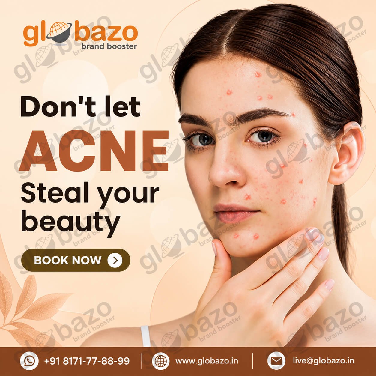 Acne Treatment (Health-398)