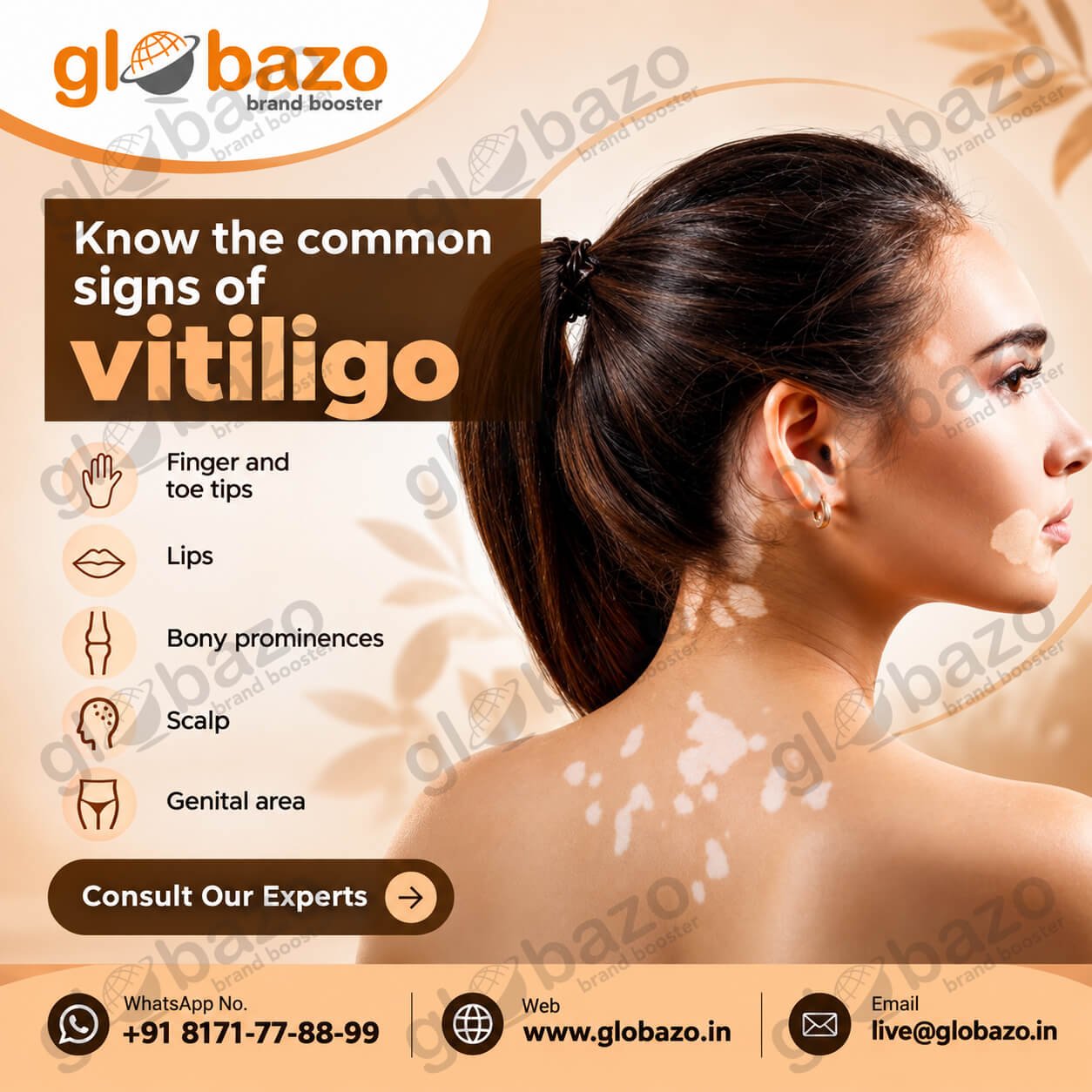 Vitiligo Awareness (Health-400)