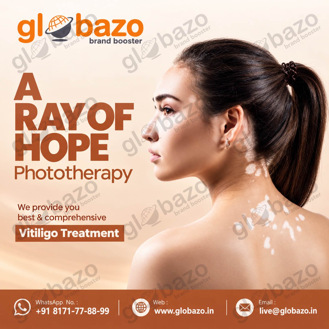 Vitiligo Phototherapy (Health-401)