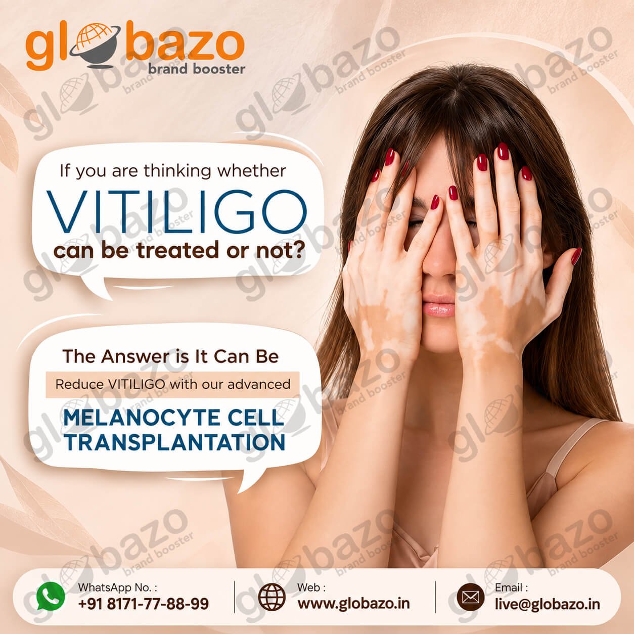 Vitiligo Treatment (Health-402)