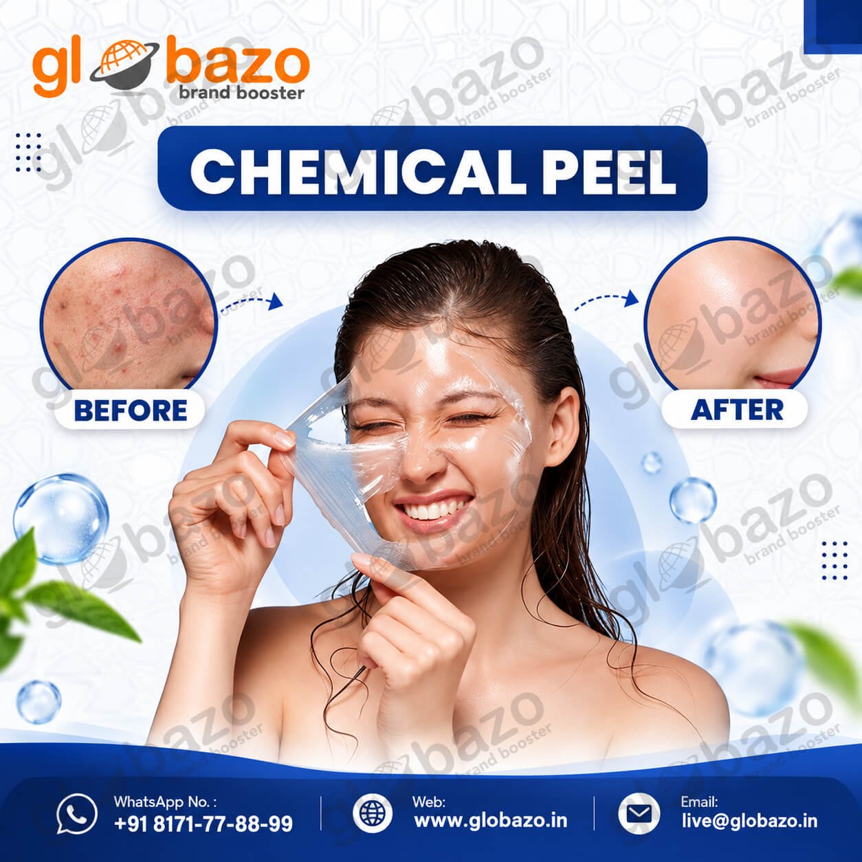 Chemical Peel Treatment (Health-408)