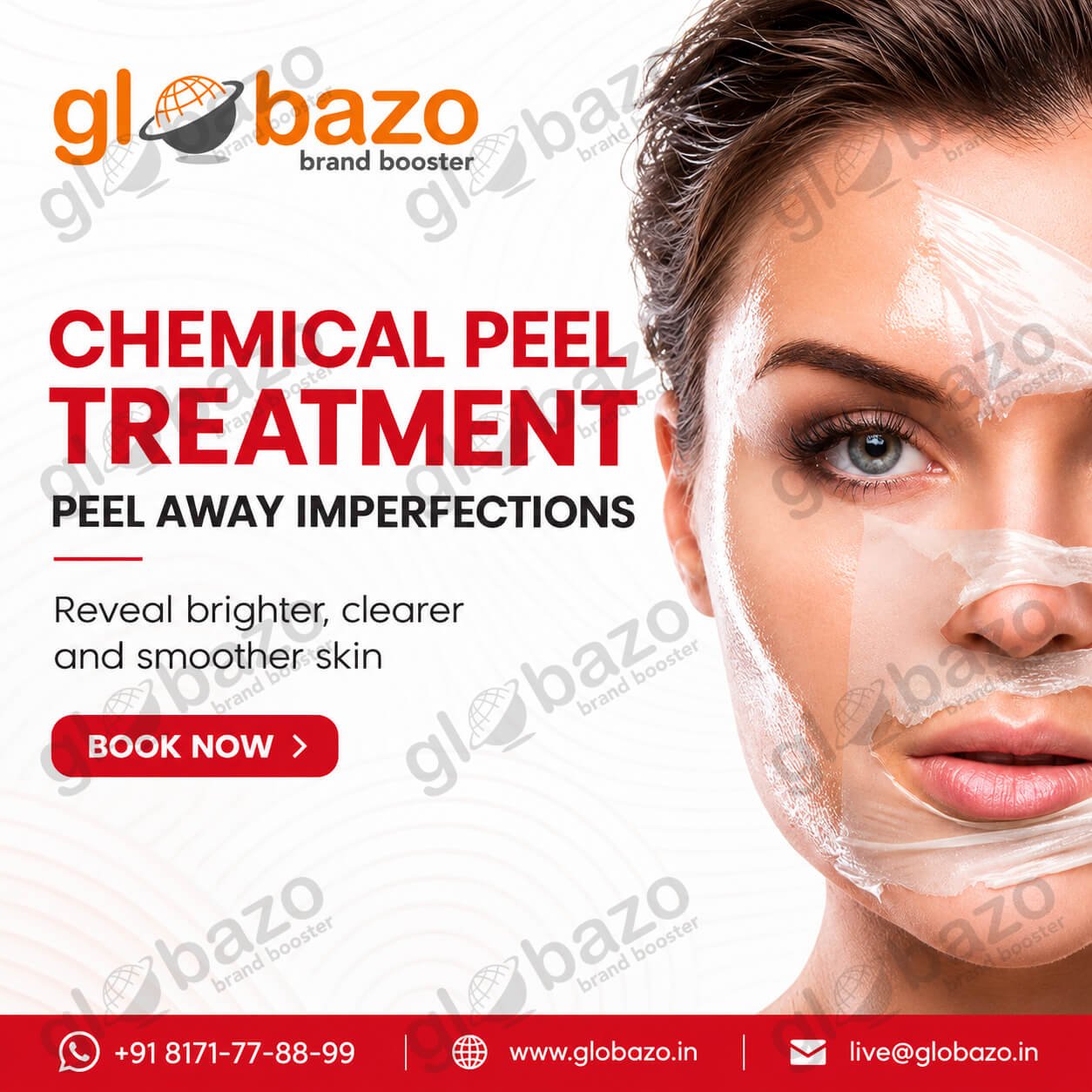 Chemical Peel Treatment (Health-410)