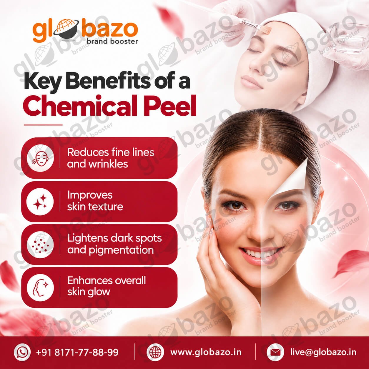 Chemical Peel Treatment (Health-412)