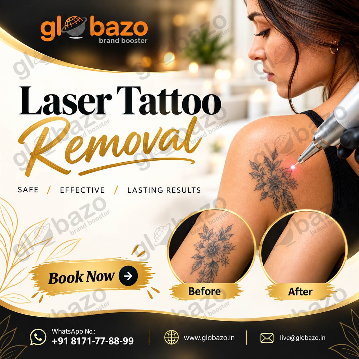 Laser Tattoo Removal Treatment (Health-426)