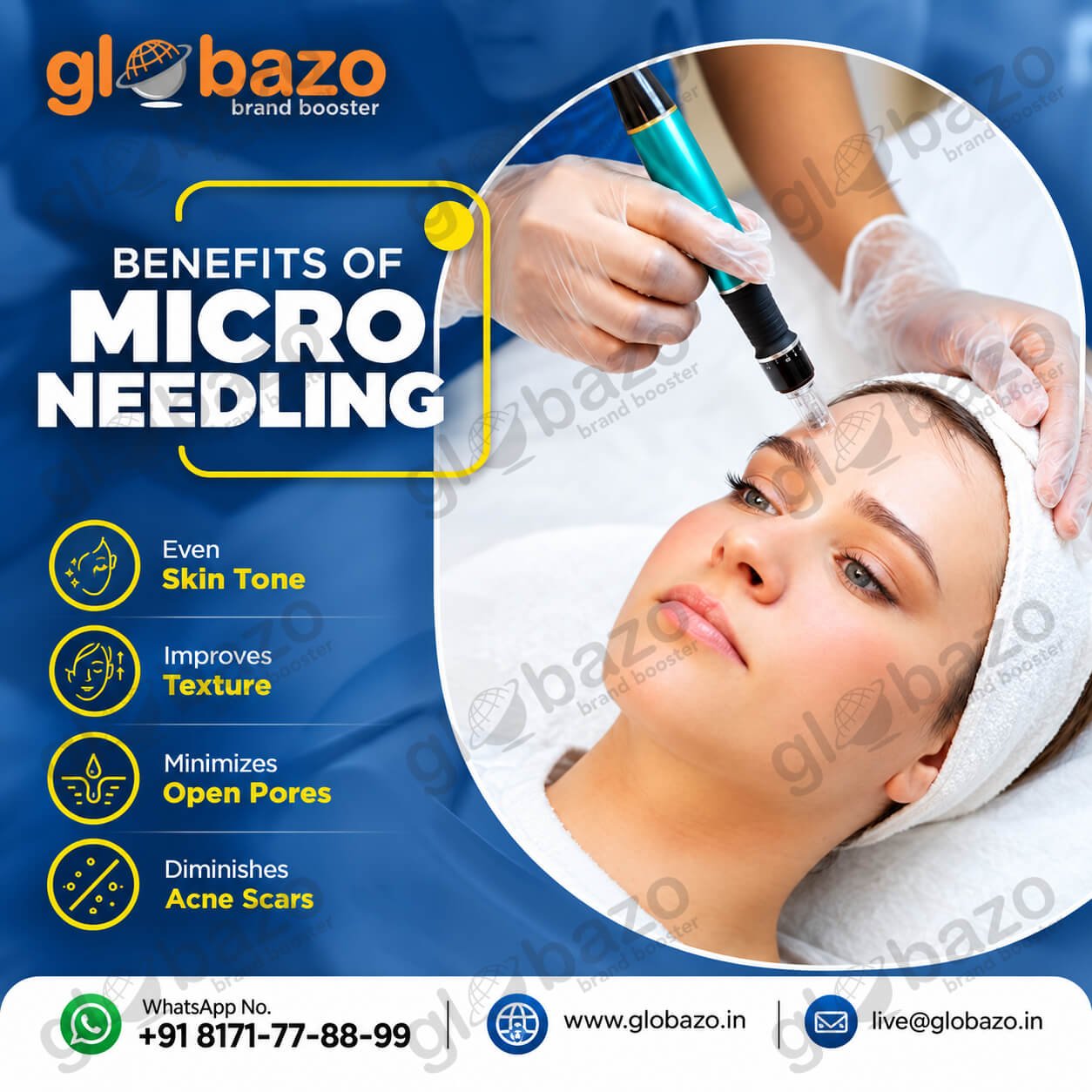 Microneedling Treatment (Health-437)