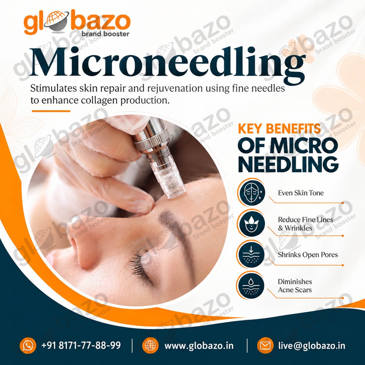 Microneedling Treatment (Health-438)