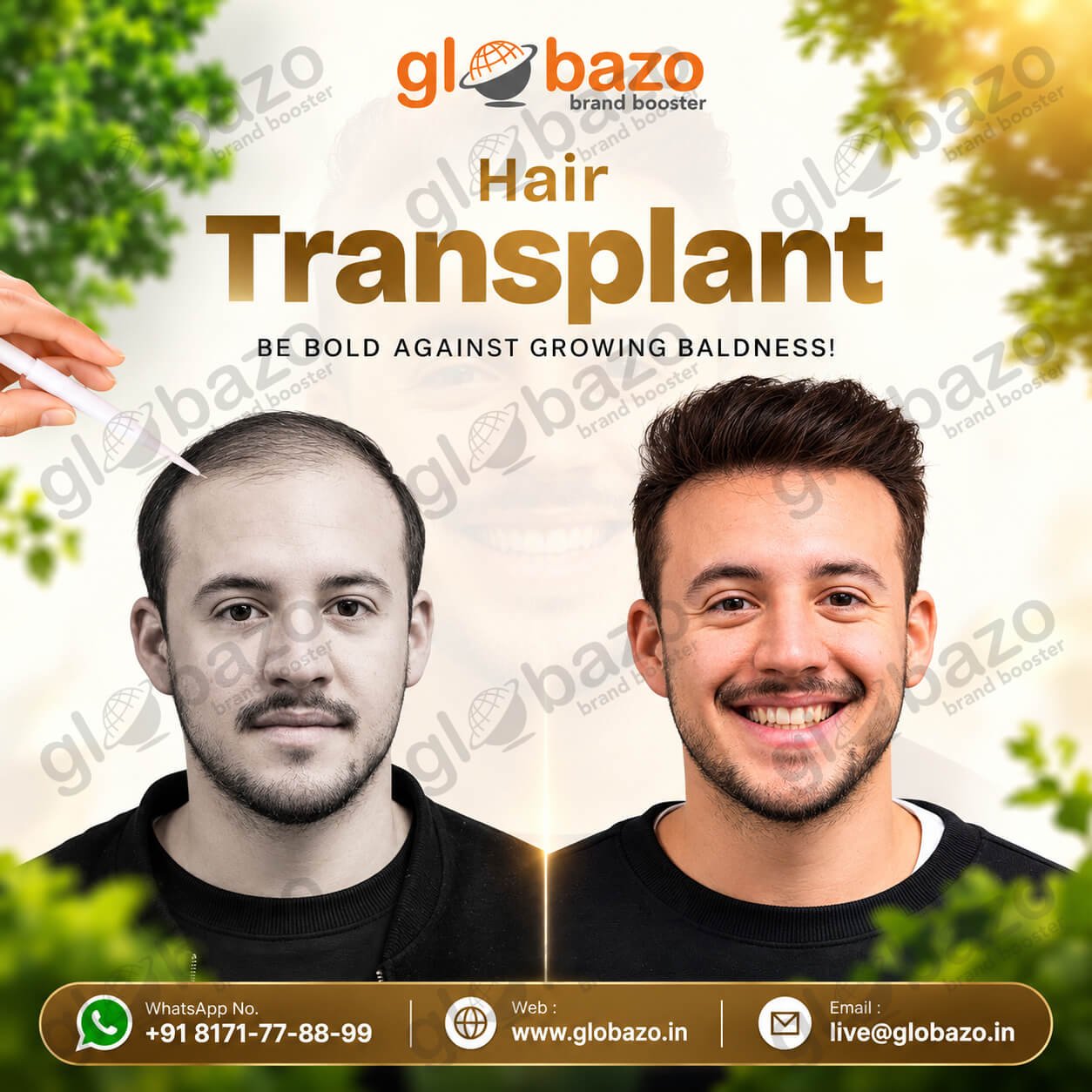 Hair Transplant Treatment (Health-446)