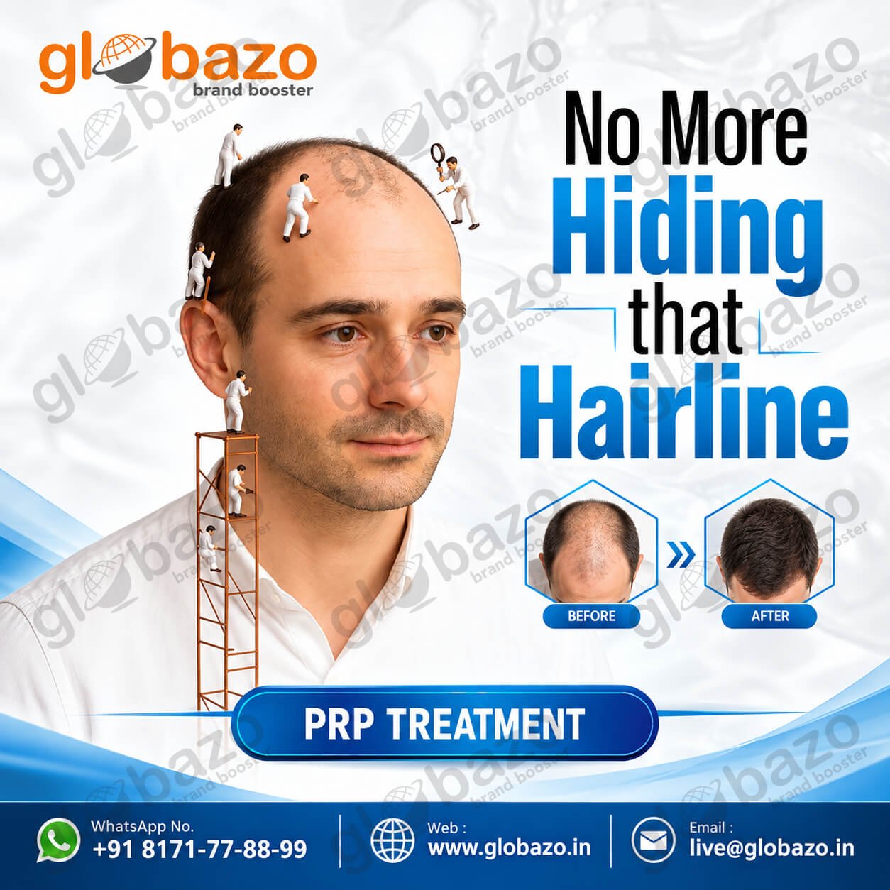Hair Restoration Treatment (Health-447)