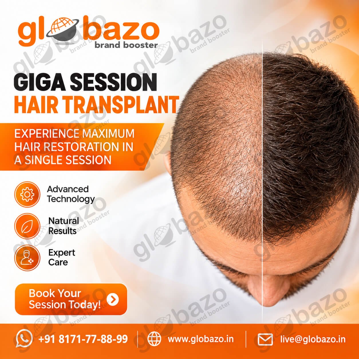 Hair Transplant Treatment (Health-448)