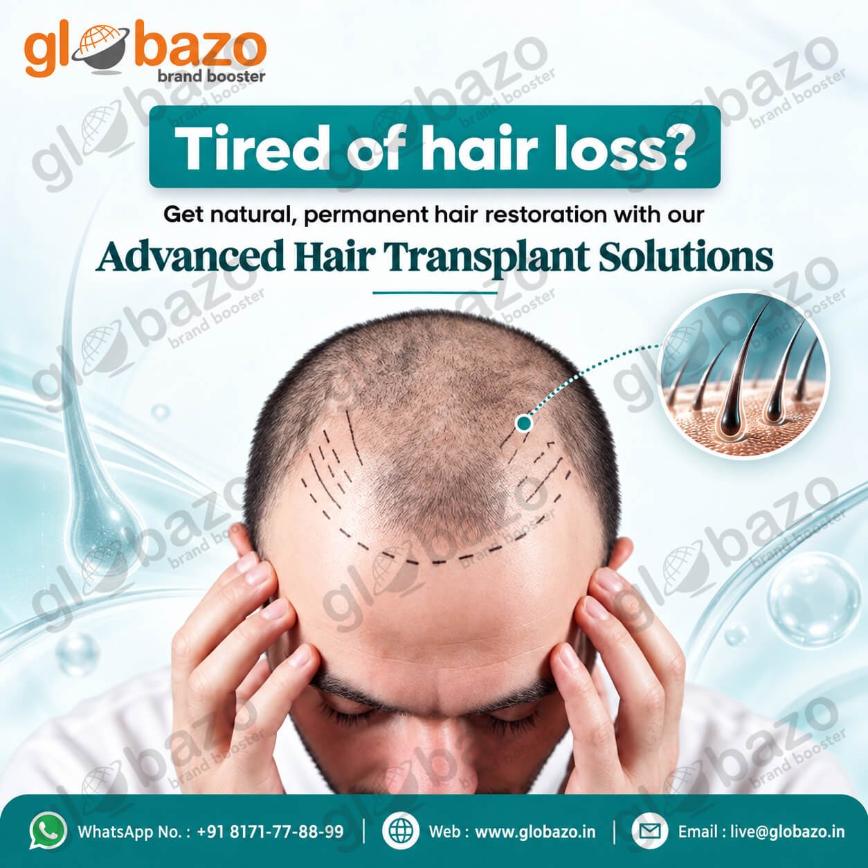 Hair Transplant Treatment (Health-449)